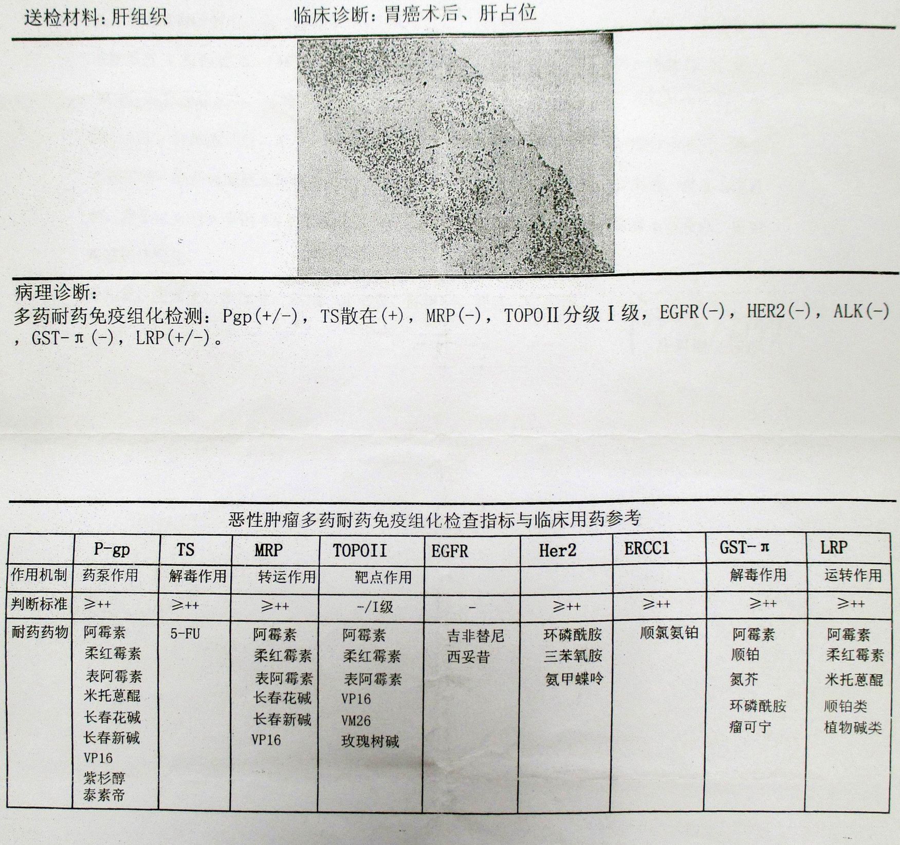 组化