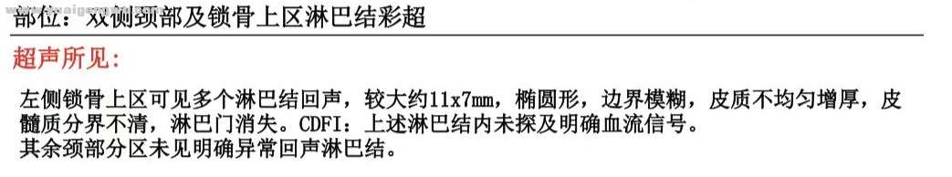 左侧锁骨上区见多个淋巴结